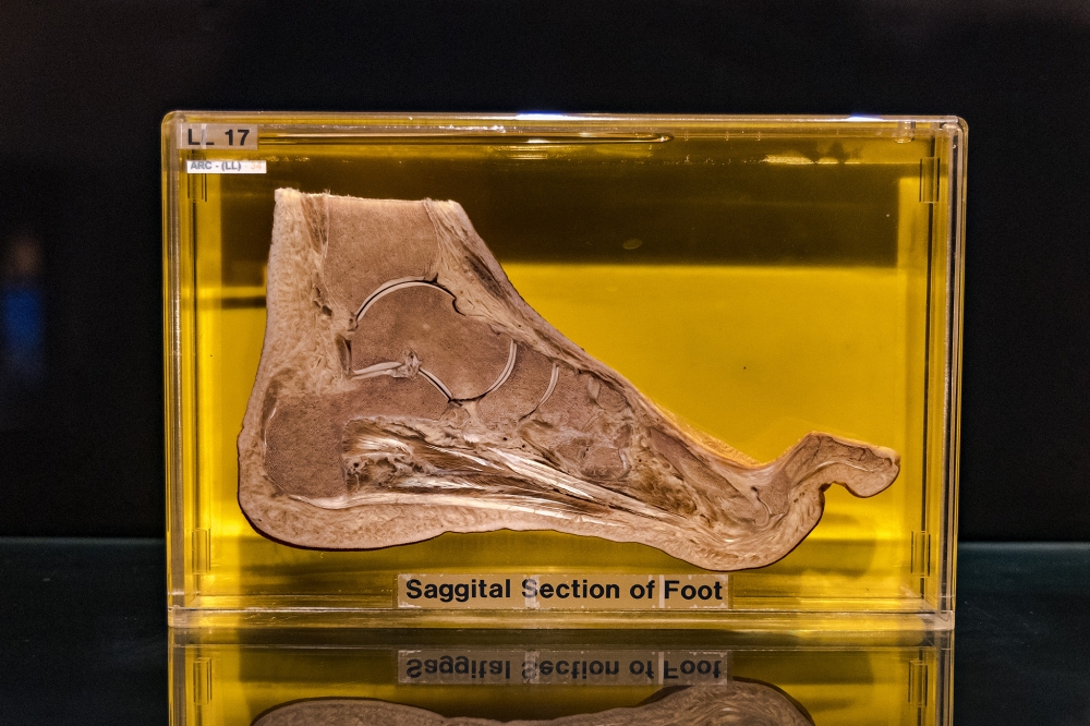 268612 A section of a foot. — Picture by Firdaus Latif