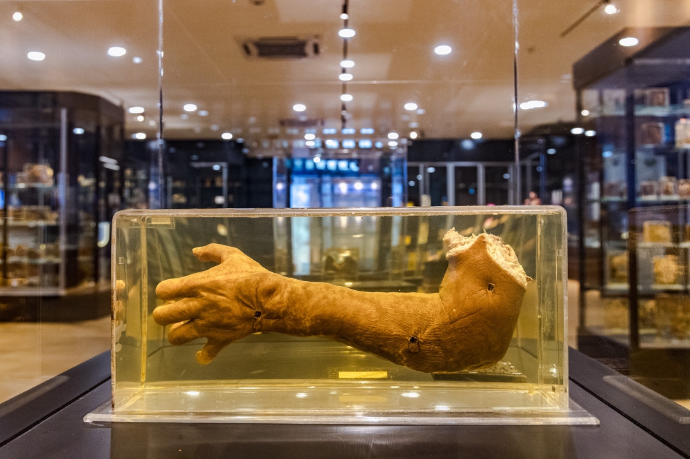 268616 A hand preserved in Kaiserling solution to preserve and stabilise tissue specimens. — Picture by Firdaus Latif